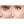 Before and after close-up comparison of under-eye area showing reduced dark circles and improved skin brightness after MYCHWAY hydro dermabrasion facial treatment