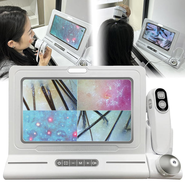 Skin Diagnosis Hair Analyzer 11-inch Skin Scalp Detector