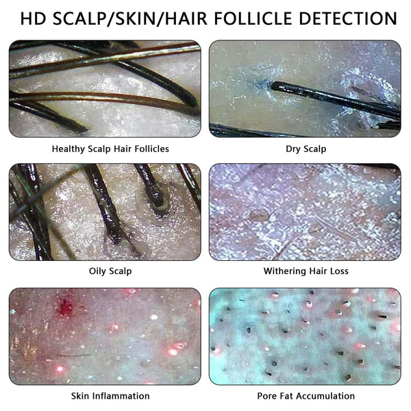 Skin Diagnosis Hair Analyzer 11-inch Skin Scalp Detector