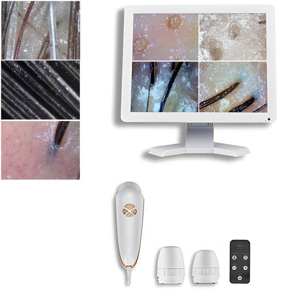 Portable Facial and Scalp Skin Analyzer Machine