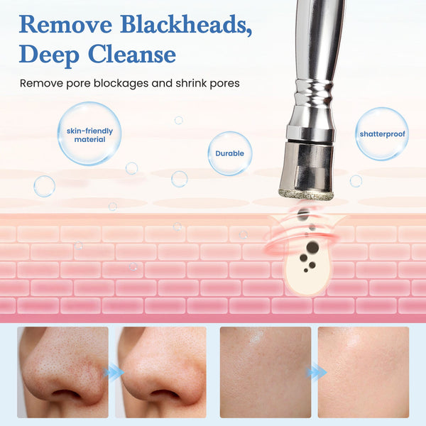 A skincare promotional graphic with the text 'Remove Blackheads, Deep Cleanse' and 'Remove pore blockages and shrink pores.' A metallic facial cleansing tool is shown above a stylized pink skin layer with bubbles and feature callouts like 'skin-friendly material,' 'Durable,' and 'shatterproof.