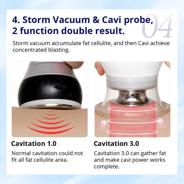 CaVstorm 40K Cavitation Machine With Vacuum & RF For Body Contouring