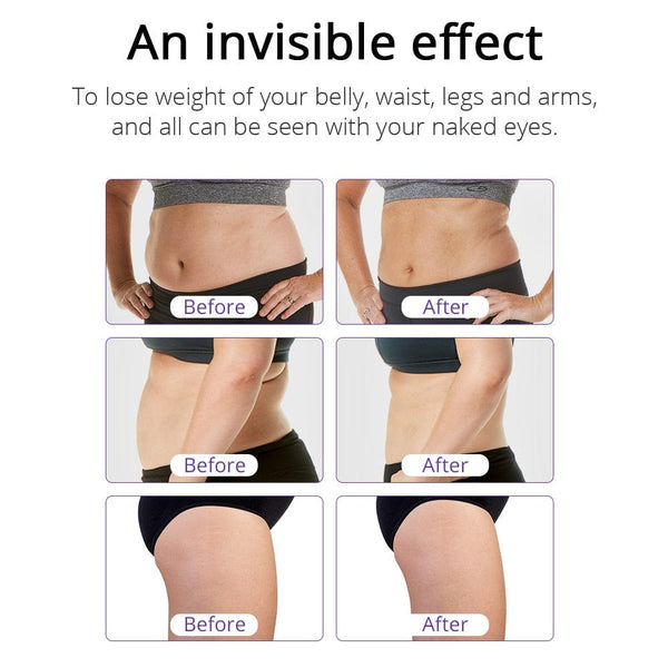 CaVstorm 40K Cavitation RF Body Slimming Tightening Machine
