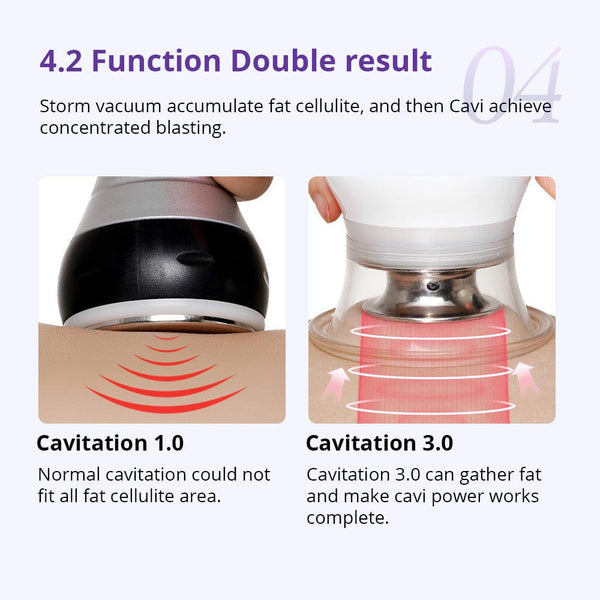 CaVstorm 40K Cavitation RF Body Slimming Tightening Machine