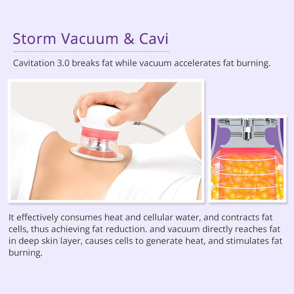 CaVstorm 40K Cavitation RF Body Slimming Tightening Machine