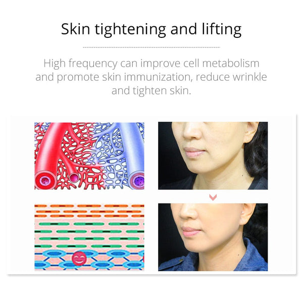 Mychway High Frequency Facial Device For Anti-Inflammation With 4 Electrodes