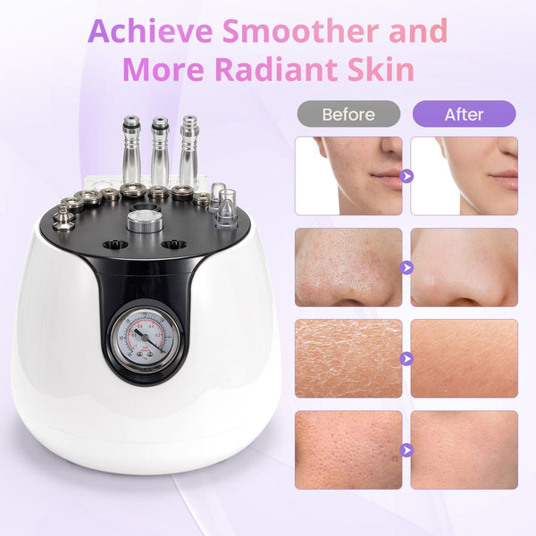 Before & After Results of SR-NF200 3-In-1 Diamond Microdermabrasion Machine