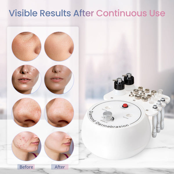 Home Use Diamond Microdermabrasion Machine