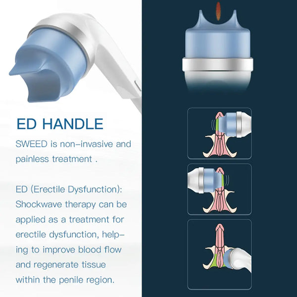 Extracorporeal Shockwave Therapy SW ED Pain Relief Physiotherapy Machine