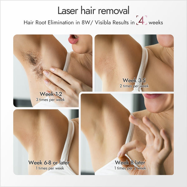 NAISIGOO Professional IPL Hair Removal Device