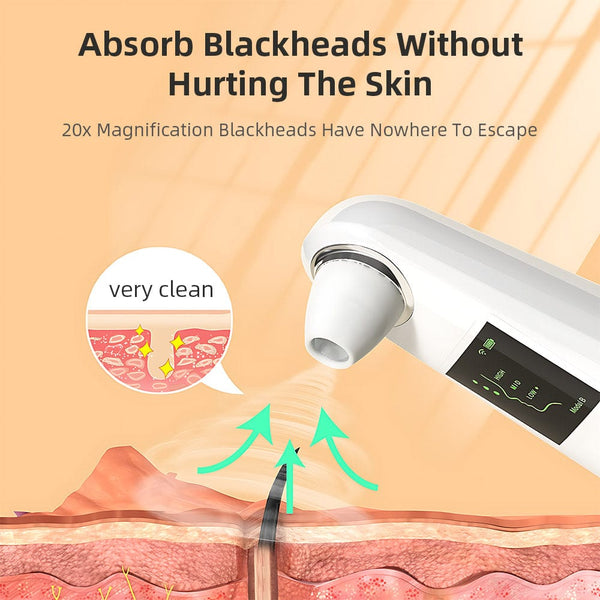 Principles of SR-H300 Portable Blackhead Remover 