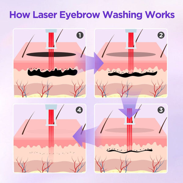 Working Principles of HR-AS64 2-In-1 Picosecond 808 Diode Laser Machine