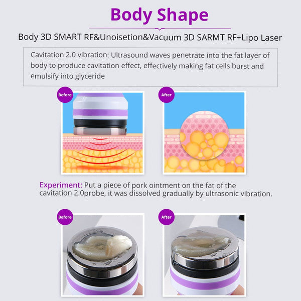 6 in 1 Unoisetion Lipo Cavitation 2.0 RF Body Contouring Machine