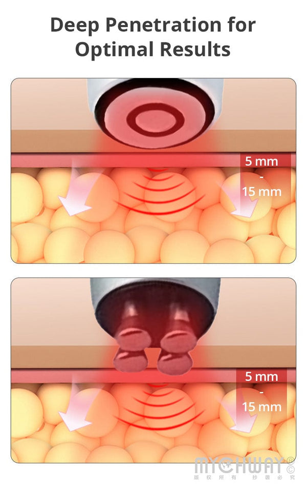 Deep Penetration of SR-MINIRF4 Portable RF Facial Care Beauty Device