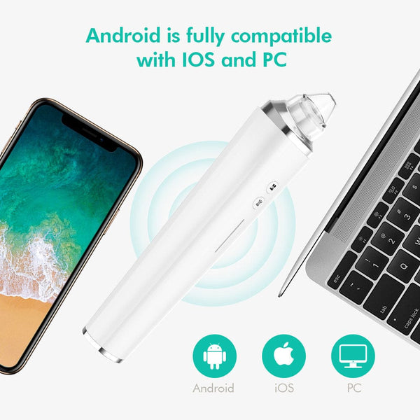 Blackhead Remover Tool With HD Camera For Visual Blackhead Removal