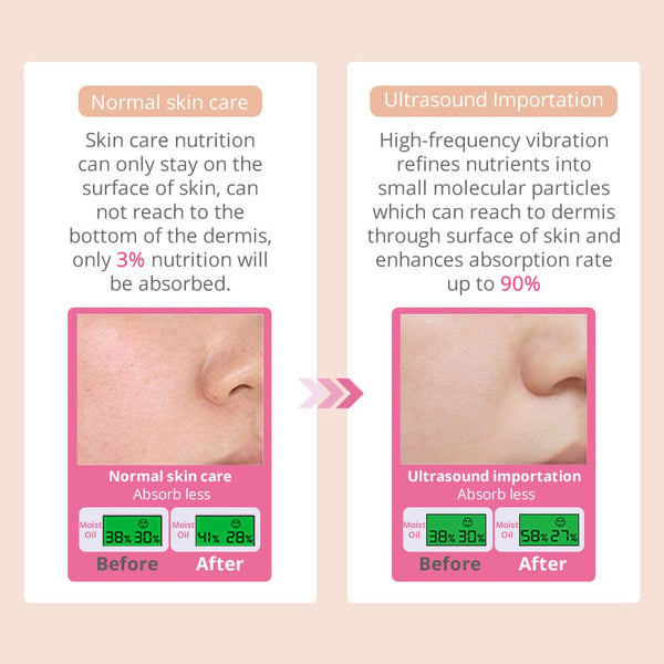 Skin Comparison Between Normal Skincare & Ultrasound Importation