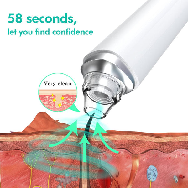 Blackhead Remover Tool With HD Camera For Visual Blackhead Removal