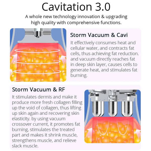 CaVstorm 40K Ultrasonic Cavitation Machine With Bio & Photon For Body Sculpting