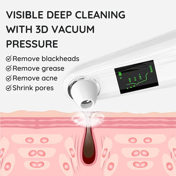 SR-H300 Portable Blackhead Remover For Deep Cleansing