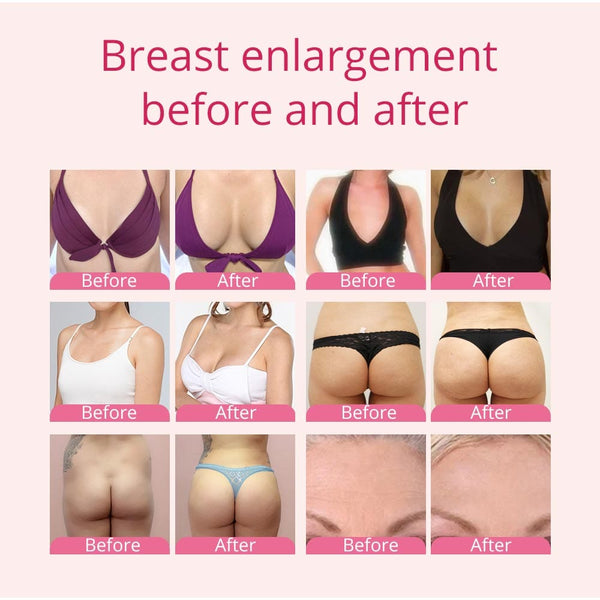 Vacuum Therapy Machine Breast Enlargement & Butt Lift Before & After