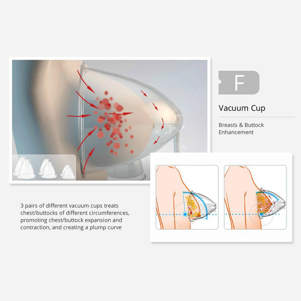 EMS Microcurrent Machine With Cupping Therapy For Muscle Toning Butt Lift