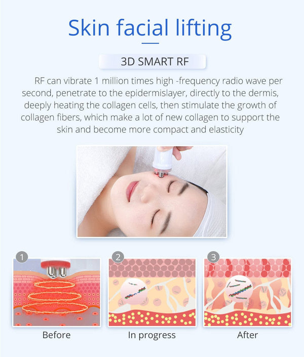 Principles of 3D Smart RF For Facial Lifting