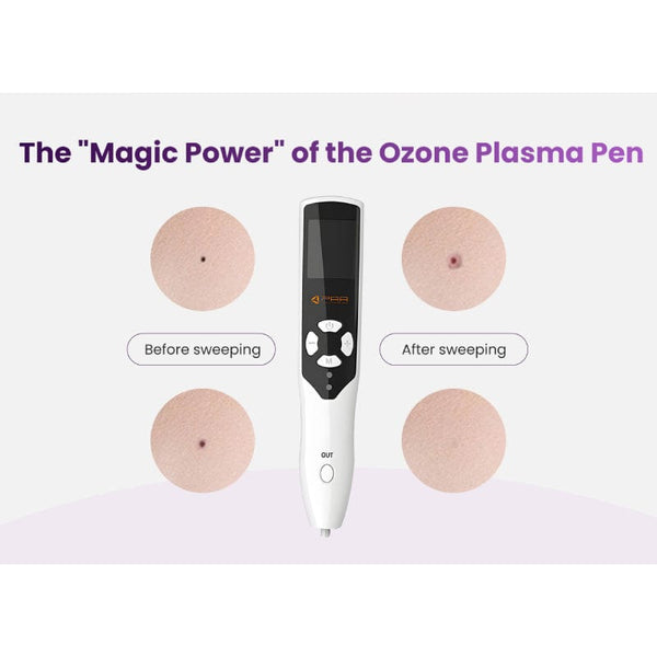 Mychway Mini Ozone Plasma Pen For Skin Rejuvenation