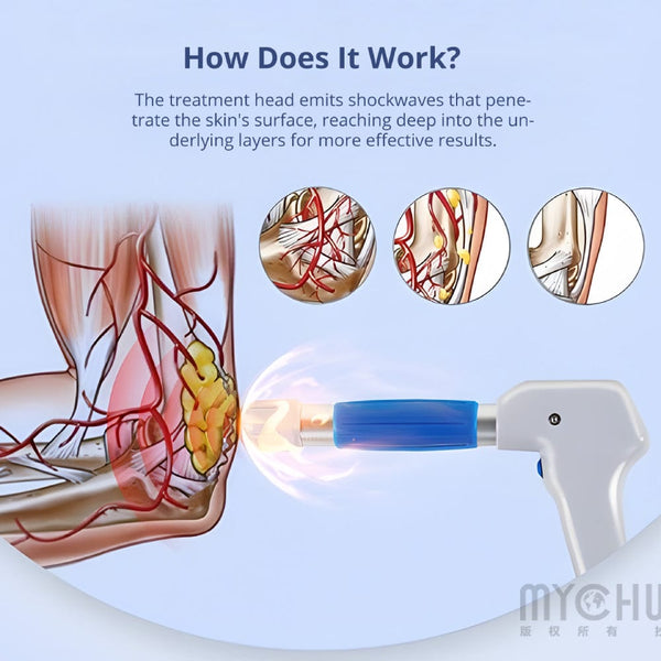 Mychway Shockwave Therapy Machine With 5 Working Head For Body Pain Relief