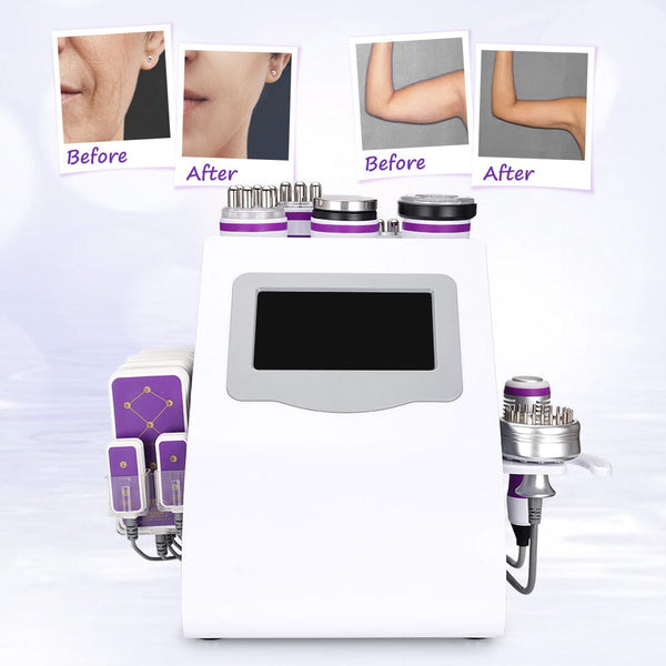 MS-76D1MAXSB 9-In-1 40K Cavitation Machine's Before & After Results