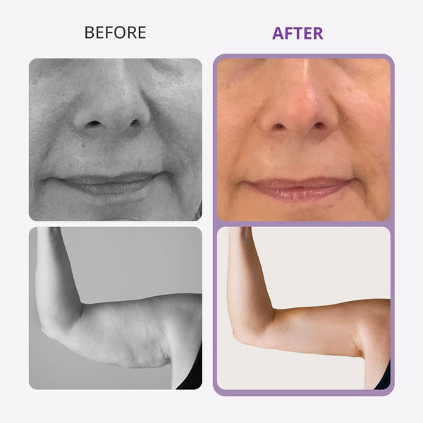 Mychway 9-In-1 40K Cavitation Machine For Body Shaping & Facial Care