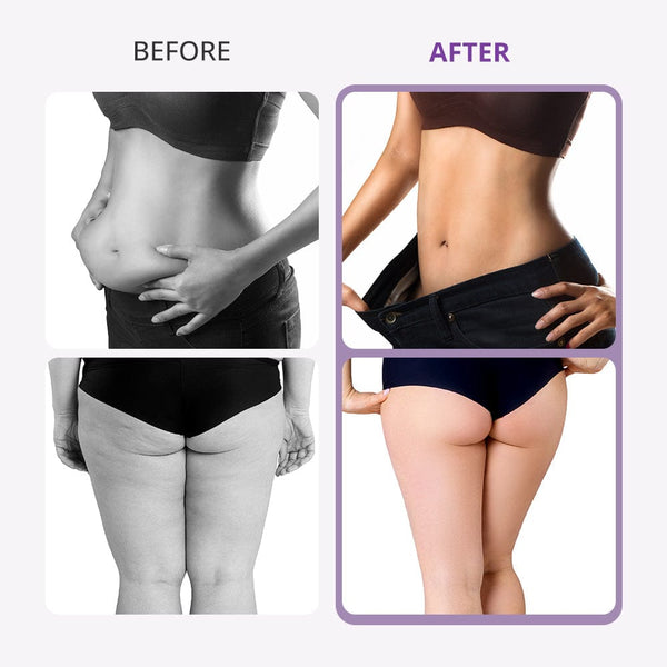 Mychway 9-In-1 40K Cavitation Machine For Body Shaping & Facial Care