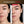 Before and after comparison of a woman's face with acne, showing improvement over 4 weeks.
