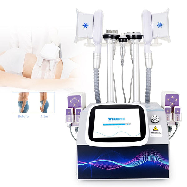 Before & After Results of SM-7205N 5-In-1 Body Freezing Machine