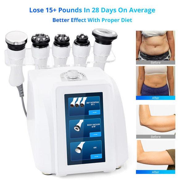 MS-21S8 5-In-1 Cavitation Machine with 360° Rotary RF Before & After Results