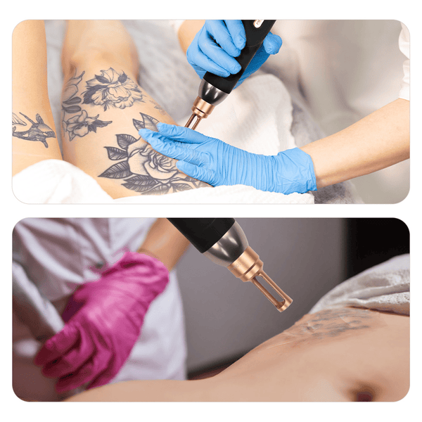 Picosecond Laser Machine With 3 Laser Head For Tattoo Removal Carbon Facial Peel