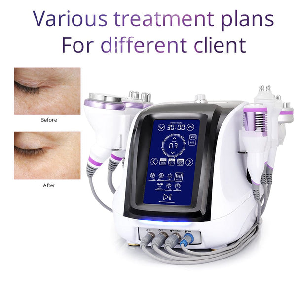 Before & After Results of LS-78D1MAX 8-In-1 40K Cavitation Machine 