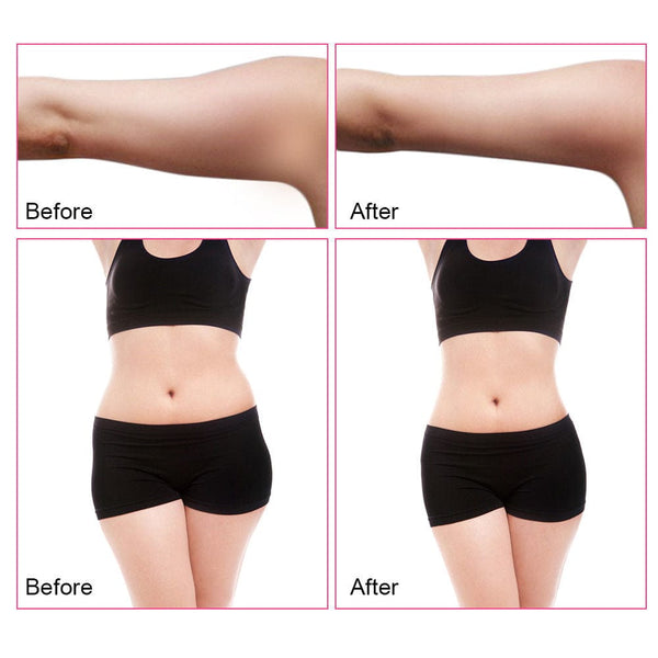 WL-519 3-In-1 40K Cavitation Machine Before & After Body Sculpting Results