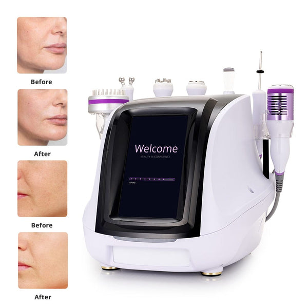 Before & After Results of LS-78D3 8-In-1 Ultrasonic Beauty Machine